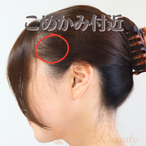 こめかみ付近の白髪
